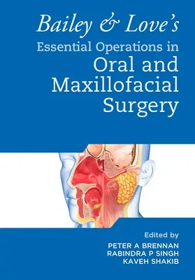 Operaciones Esenciales en Cirugía Oral y Maxilofacial de Bailey & Love - Bailey & Love's Essential Operations in Oral & Maxillofacial Surgery