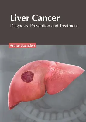 Cáncer de hígado: Diagnóstico, prevención y tratamiento - Liver Cancer: Diagnosis, Prevention and Treatment