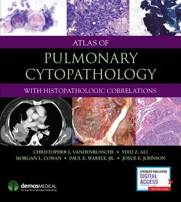 Atlas de Citopatología Pulmonar - Atlas of Pulmonary Cytopathology