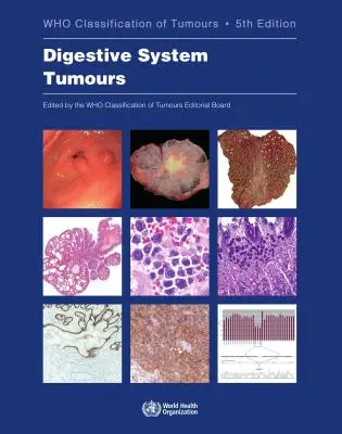 Tumores del aparato digestivo: Quién clasifica los tumores - Digestive System Tumours: Who Classification of Tumours