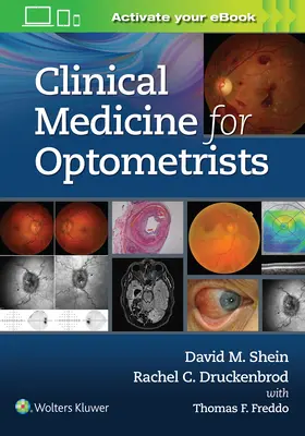 Medicina clínica para optometristas - Clinical Medicine for Optometrists