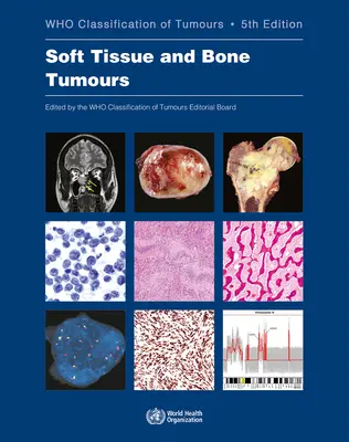 Tumores de tejidos blandos y óseos: Quién clasifica los tumores - Soft Tissue and Bone Tumours: Who Classification of Tumours