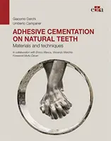 Cementación adhesiva en dientes naturales - Materiales y técnicas - Adhesive cementation on natural teeth - Materials and techniques