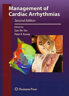 Tratamiento de las arritmias cardíacas - Management of Cardiac Arrhythmias