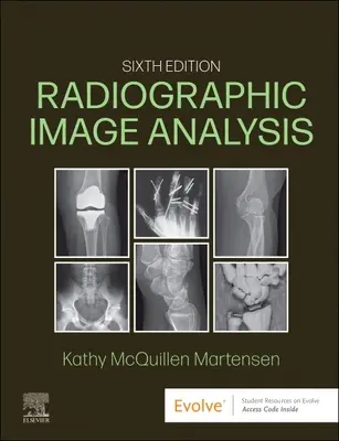 Análisis de Imágenes Radiográficas - Radiographic Image Analysis