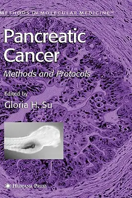 Cáncer de páncreas: Métodos y Protocolos - Pancreatic Cancer: Methods and Protocols