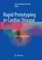 Prototipado rápido en enfermedades cardíacas: Impresión 3D del corazón - Rapid Prototyping in Cardiac Disease: 3D Printing the Heart