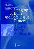 Imágenes de tumores óseos y de tejidos blandos: A Case Study Approach - Imaging of Bone and Soft Tissue Tumors: A Case Study Approach