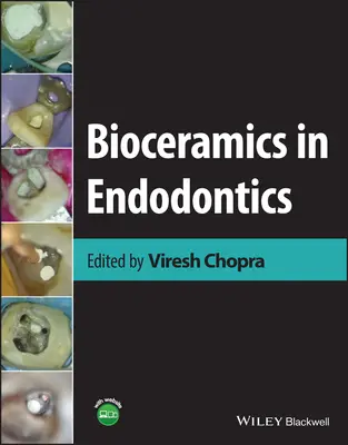 Biocerámica en endodoncia - Bioceramics in Endodontics