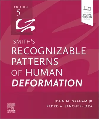 Patrones Reconocibles de Deformación Humana de Smith - Smith's Recognizable Patterns of Human Deformation