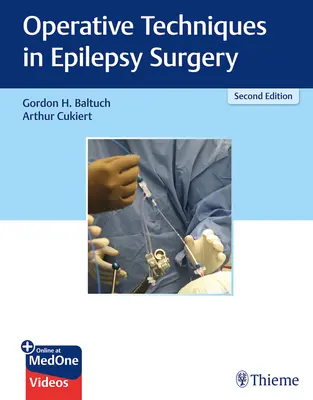 Técnicas operativas en cirugía de la epilepsia - Operative Techniques in Epilepsy Surgery