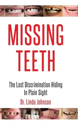 Dientes Perdidos: La última discriminación oculta a plena vista - Missing Teeth: The Last Discrimination Hiding in Plain Sight