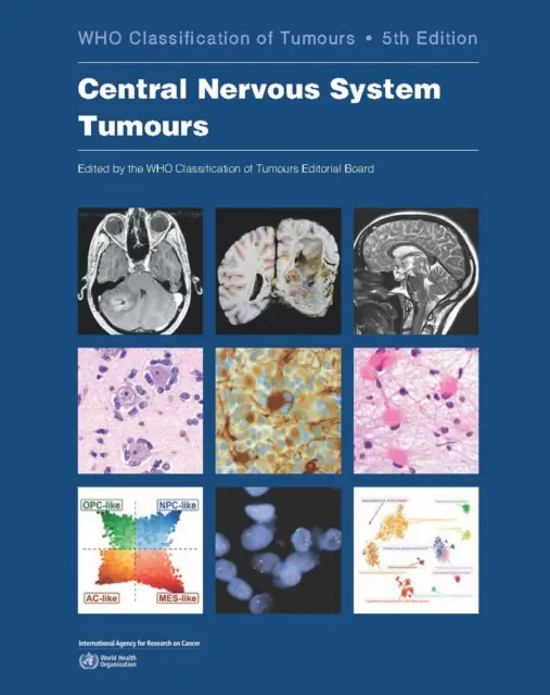 Tumores del Sistema Nervioso Central: Clasificación de los tumores - Central Nervous System Tumours: Who Classification of Tumours