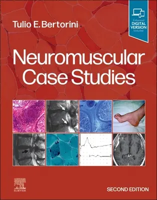 Estudios de casos neuromusculares - Neuromuscular Case Studies