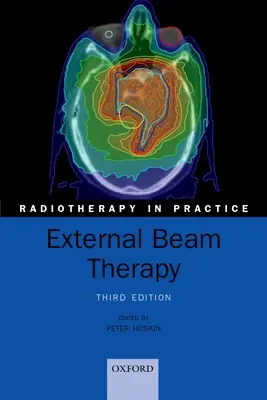 Terapia de haz externo - External Beam Therapy