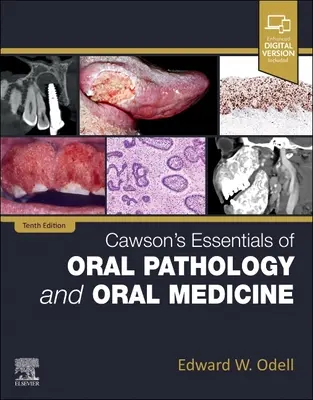 Esenciales de Patología Oral y Medicina Oral de Cawson - Cawson's Essentials of Oral Pathology and Oral Medicine