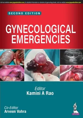 Urgencias ginecológicas - Gynecological Emergencies