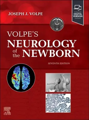 Neurología del recién nacido, de Volpe - Volpe's Neurology of the Newborn