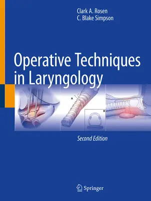 Técnicas operatorias en laringología - Operative Techniques in Laryngology