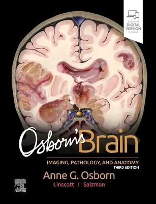 El cerebro de Osborn - Osborn's Brain