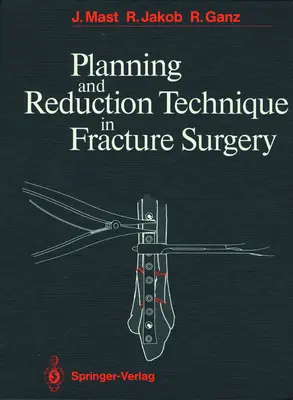 Técnica de planificación y reducción en cirugía de fracturas - Planning and Reduction Technique in Fracture Surgery