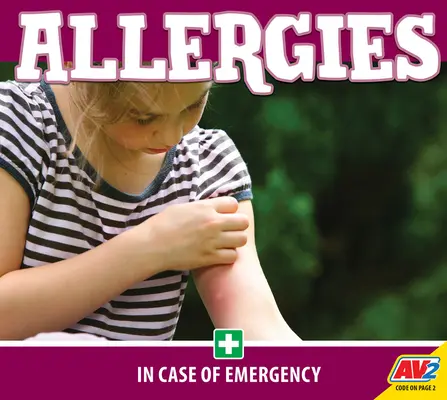 Alergias - Allergies