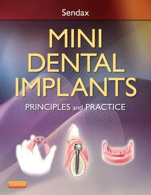 Mini Implantes Dentales: Principios y práctica - Mini Dental Implants: Principles and Practice