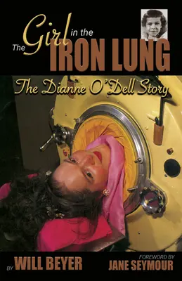 La chica del pulmón de hierro: La historia de Dianne O'Dell - The Girl in the Iron Lung: The Dianne O'Dell Story