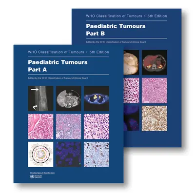 Tumores Pediátricos: Quién Clasifica los Tumores - Paediatric Tumours: Who Classification of Tumours