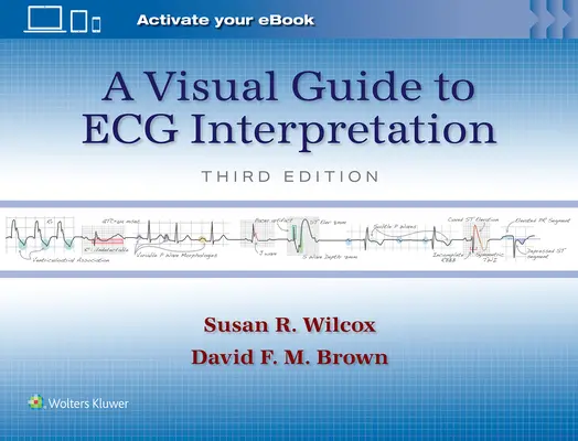 Guía visual para la interpretación de ECG - A Visual Guide to ECG Interpretation