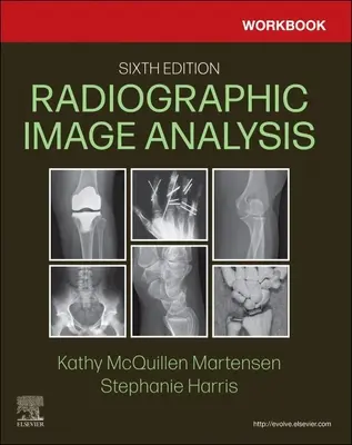 Cuaderno de trabajo para el análisis de imágenes radiográficas - Workbook for Radiographic Image Analysis