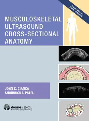 Anatomía transversal de la ecografía musculoesquelética - Musculoskeletal Ultrasound Cross-Sectional Anatomy