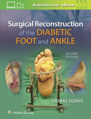 Reconstrucción quirúrgica del pie y tobillo diabéticos - Surgical Reconstruction of the Diabetic Foot and Ankle