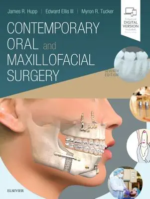 Cirugía oral y maxilofacial contemporánea - Contemporary Oral and Maxillofacial Surgery