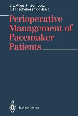 Manejo perioperatorio de pacientes con marcapasos - Perioperative Management of Pacemaker Patients