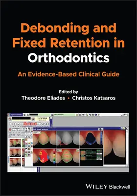 Desprendimiento y retención fija en ortodoncia: Una guía clínica basada en la evidencia - Debonding and Fixed Retention in Orthodontics: An Evidence-Based Clinical Guide